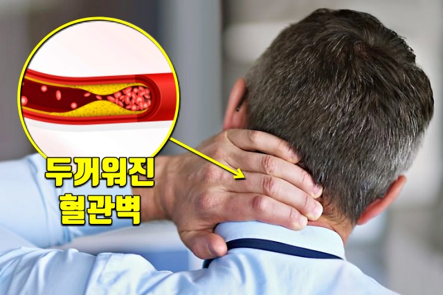 콩팥이 안좋을때 증상,고혈압,콩팥이 안좋으면 나타나는 증상