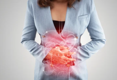 위암 3기 생존율