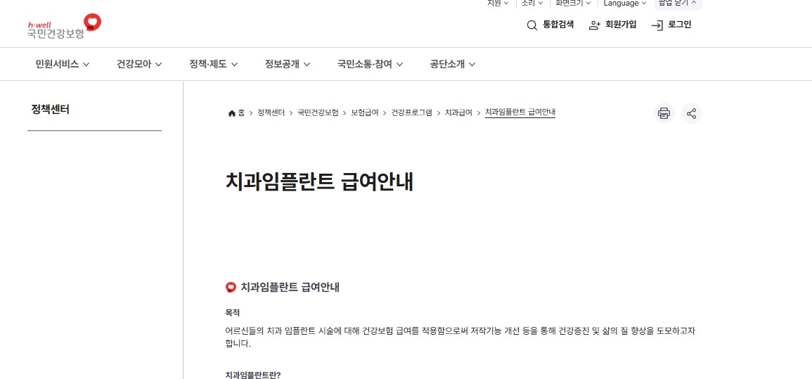 65세이상임플란트정부지원 받는방법 안내