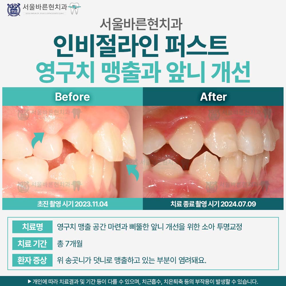 해운대인비절라퍼스트