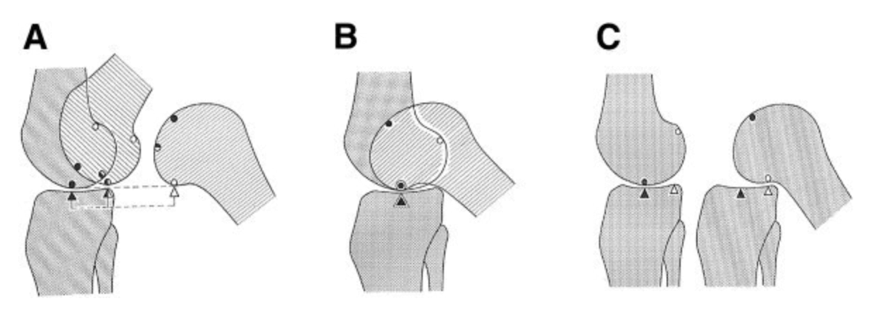 관절의 움직임표현