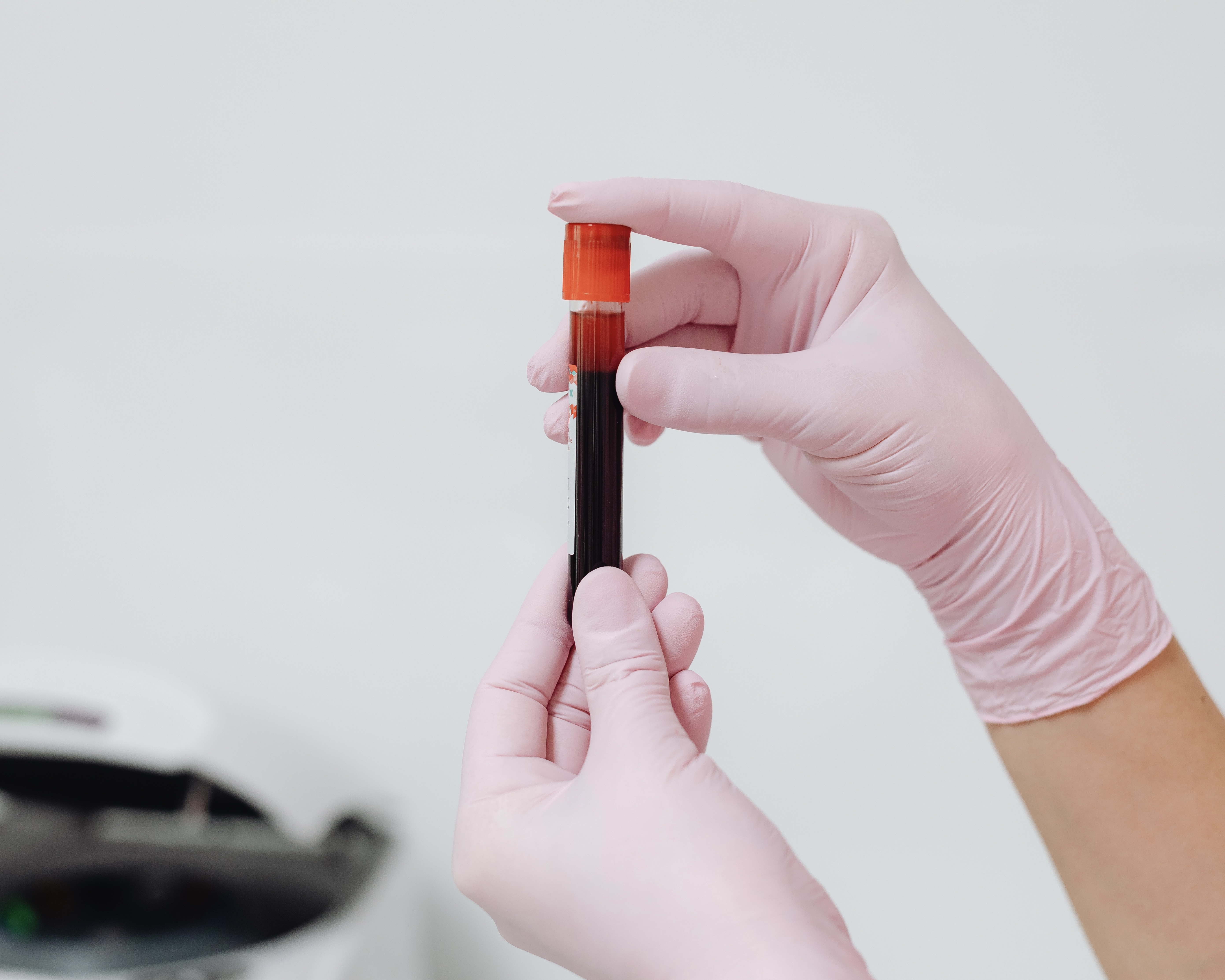 혈액검사 염증수치