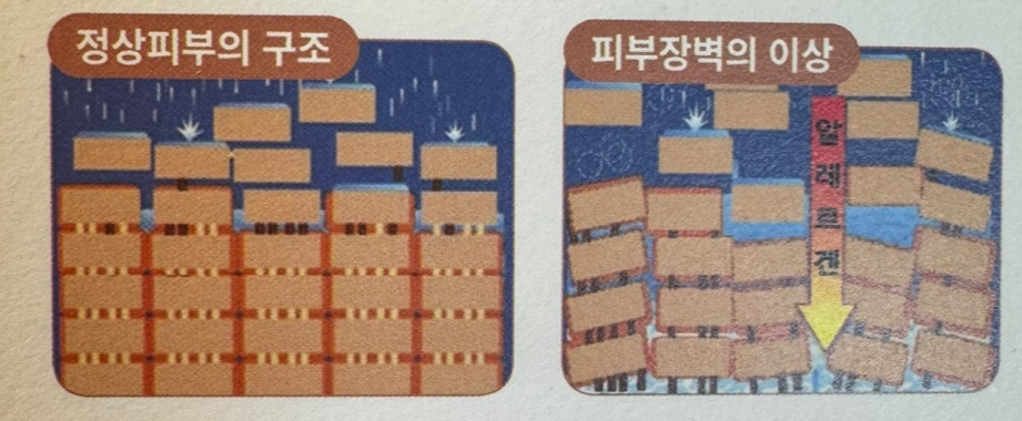 아토피피부염의 피부장벽