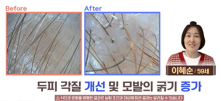아누카사과효능