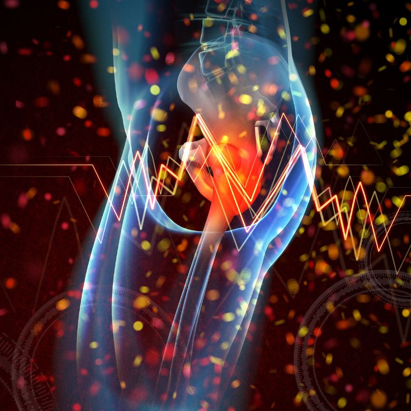 엉덩이 바깥쪽 통증