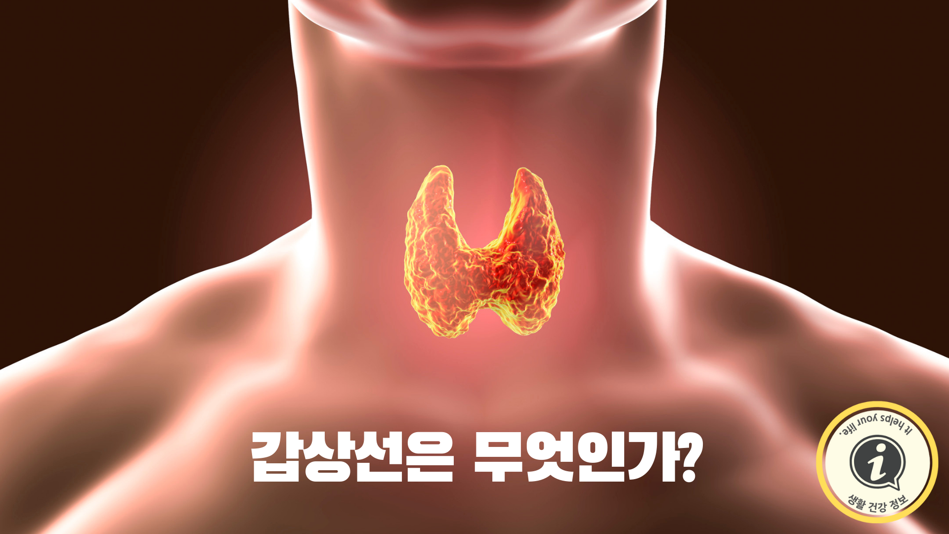 갑상선은 무엇인가?