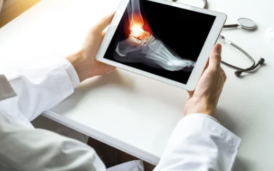 발목 염좌 병원 치료