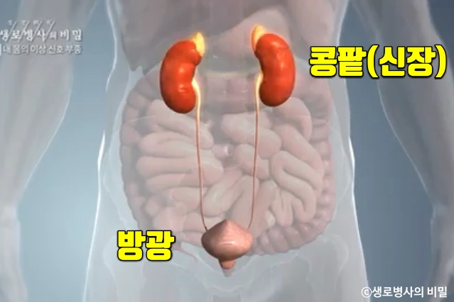 종아리 얼굴 붓는 이유, 붓기 부기 부종 원인 증상, 생로병사의 비밀, 다이어트 건강, 팁줌 매일꿀정보