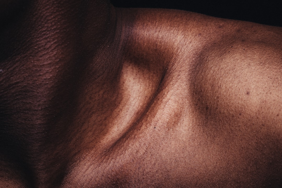 skin