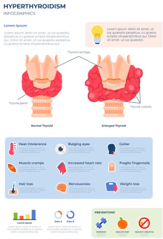 갑상선 기능 저하증 비교 분석