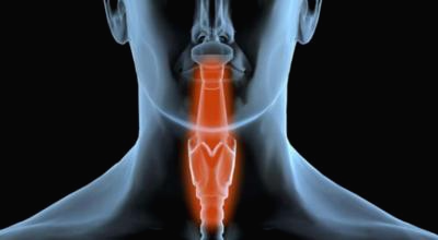 갑상선 이미지