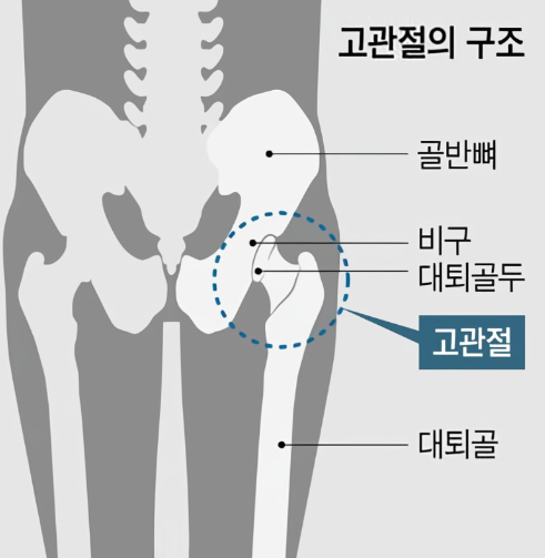 고관절의 구조