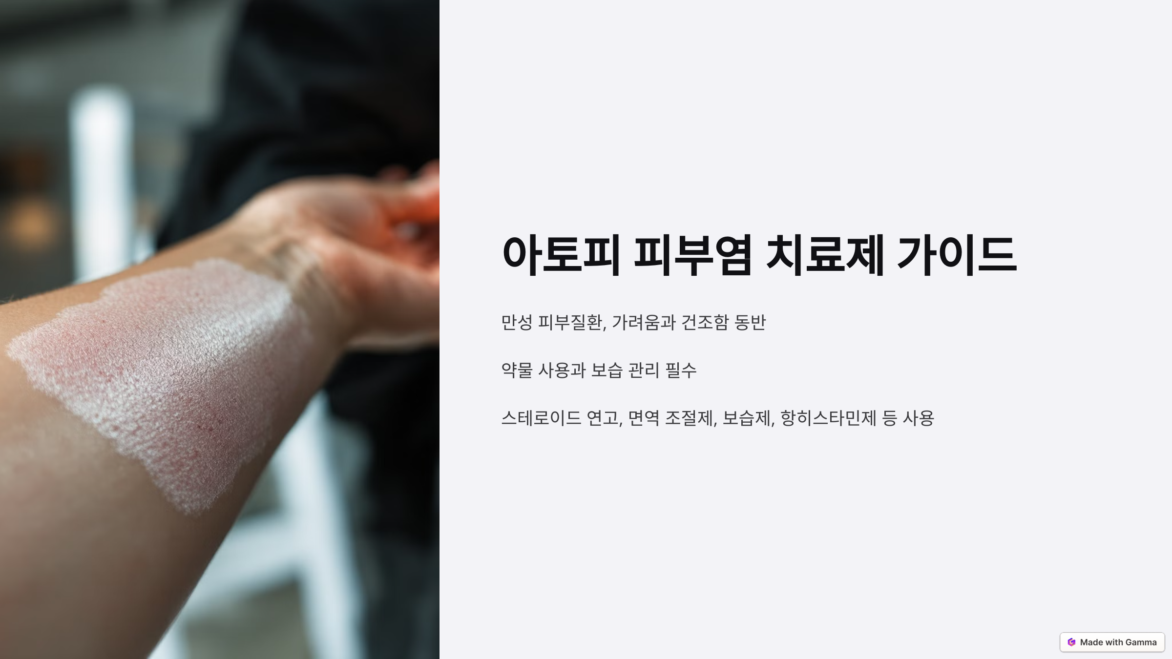 아토피 치료제 가이드