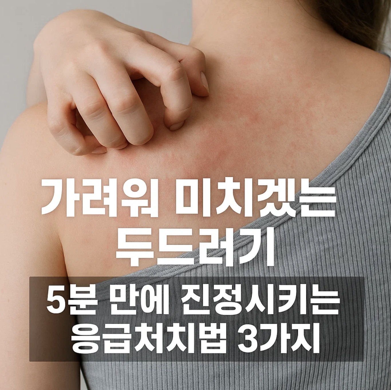 가려워 미치겠는 두드러기, 5분 만에 진정시키는 응급처치법 3가지