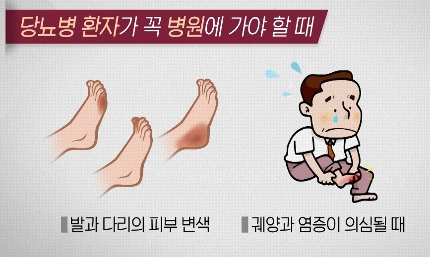 천동일-교수-당뇨병증상