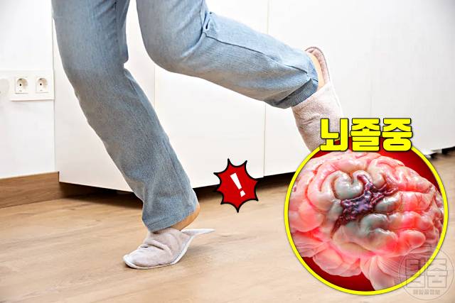 뇌졸중 전조증상 체크리스트 어지럼증 뇌졸중 전조증상 테스트