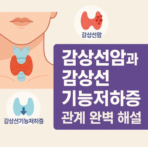 갑상선암과 갑상선기능저하 관련 사진