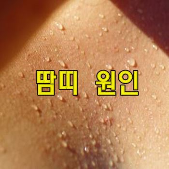 땀띠 원인