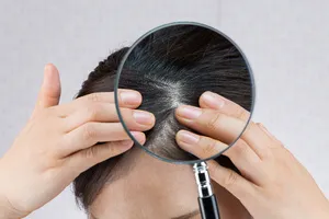 탈모-병원