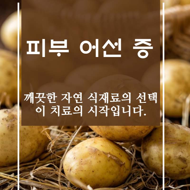 피부어선증의 증상 치료 방법