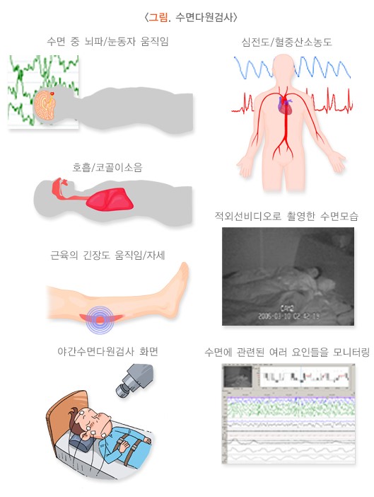 수면다원검사
