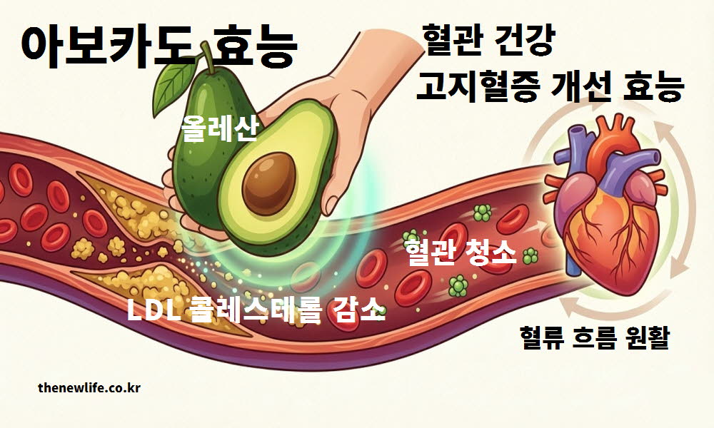 아보카도 효능 혈관 건강 고지혈증 개선