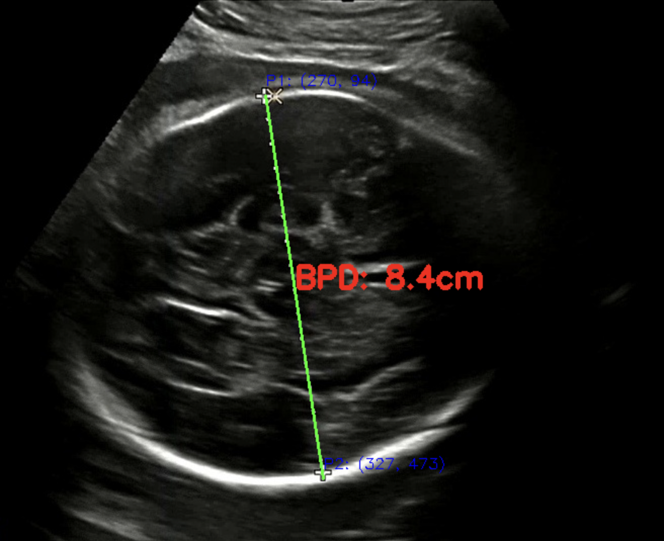 개선 후 (w/ 측정값)