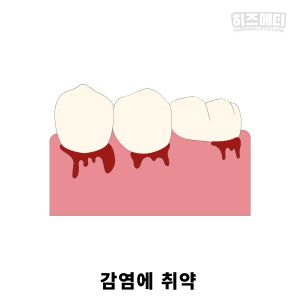 당뇨병 초기증상