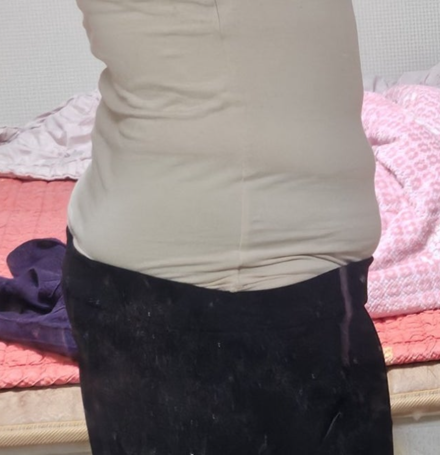 뷰앤디 슬렌웨이 내돈내산 효과