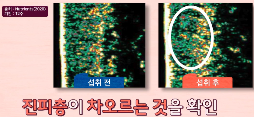 코엔자임큐텐의 효능