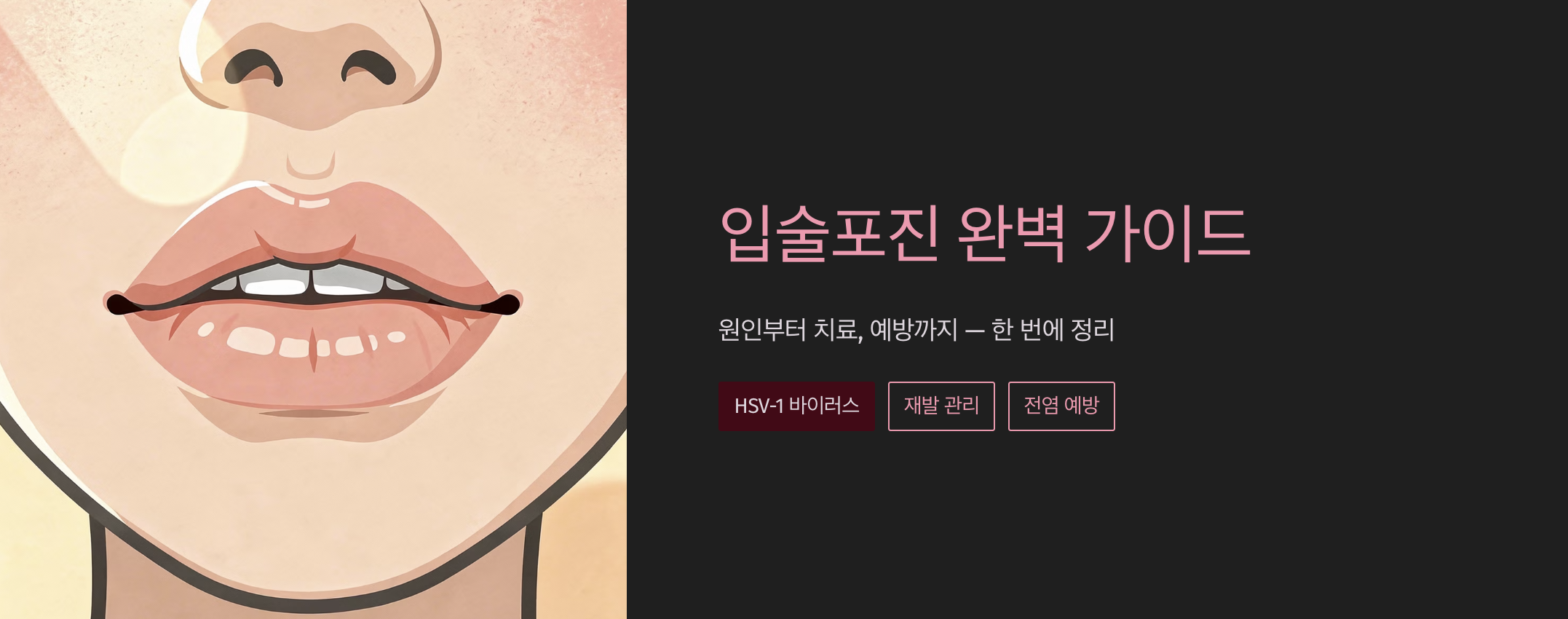 "입술포진 완벽 가이드" 문구 이미지