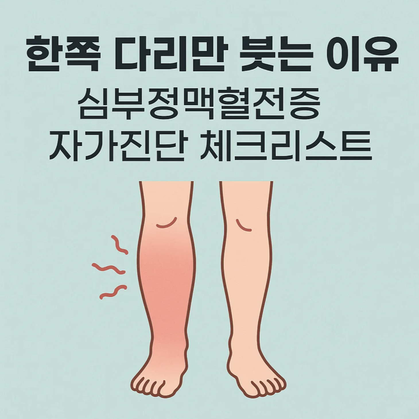 한쪽 다리만 붓는 이유, 심부정맥혈전증 자가진단 체크리스트
