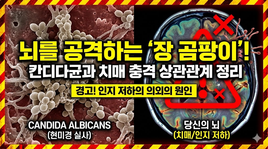 뇌를 공격하는 의외의 원인 장 곰팡이 및 칸디다 알비칸스 치매 상관관계 정리 썸네일