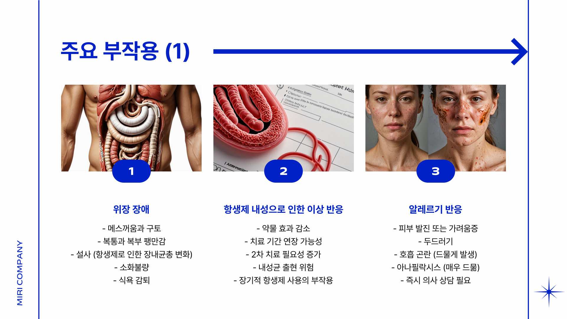 헬리코박터균 치료약 부작용