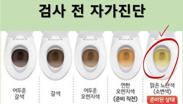 대장내시경약 쉽게 먹는 방법 (2)