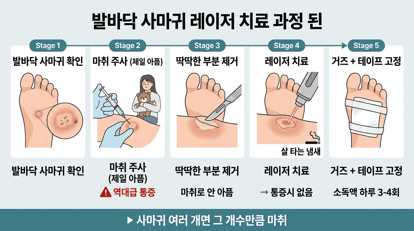 발바닥 사마귀 치료 과정