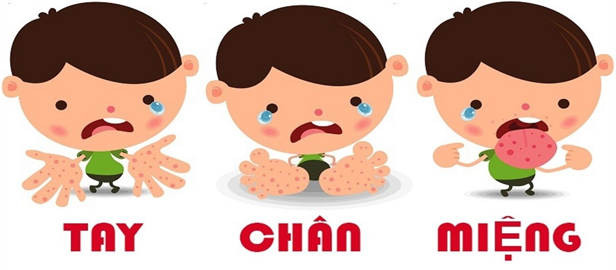 베트남어로 손발입