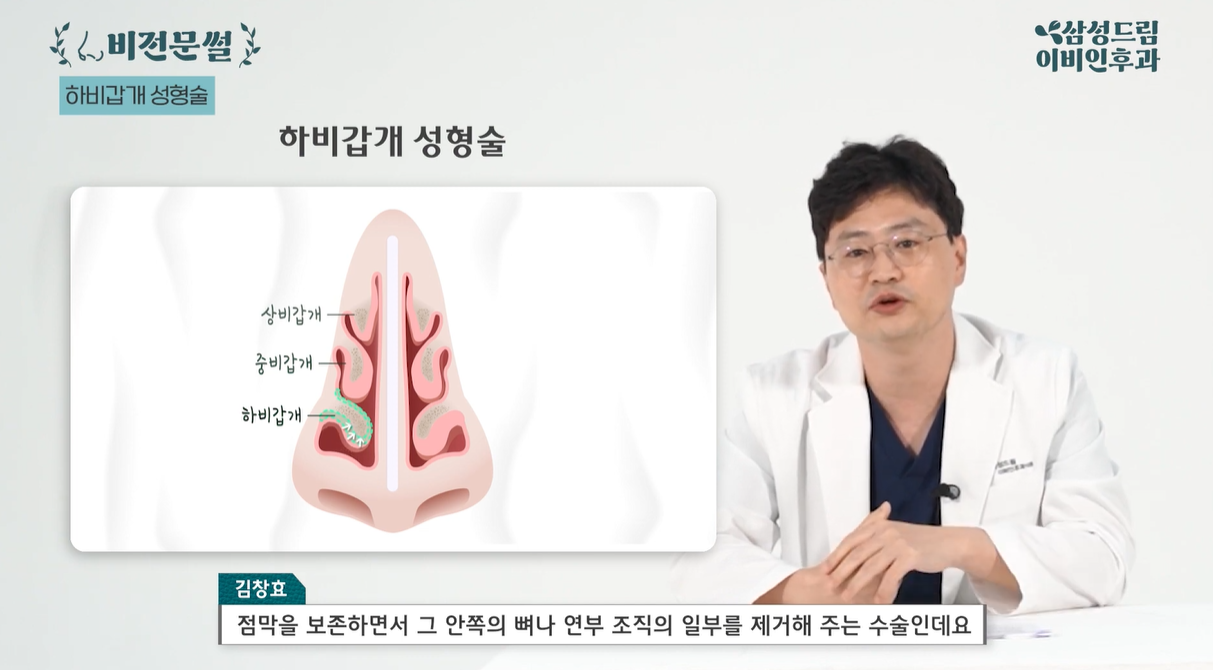 하비갑개 성형술