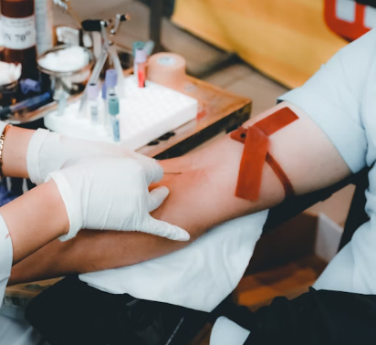 담석증 치료방법 진단기준 합병증