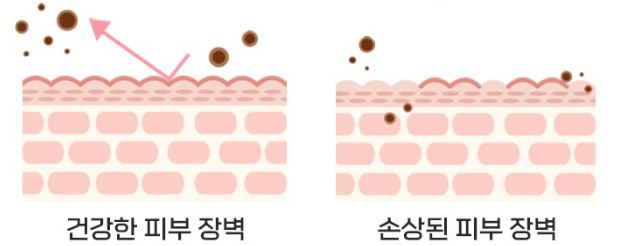 민감성 피부 체크 방법