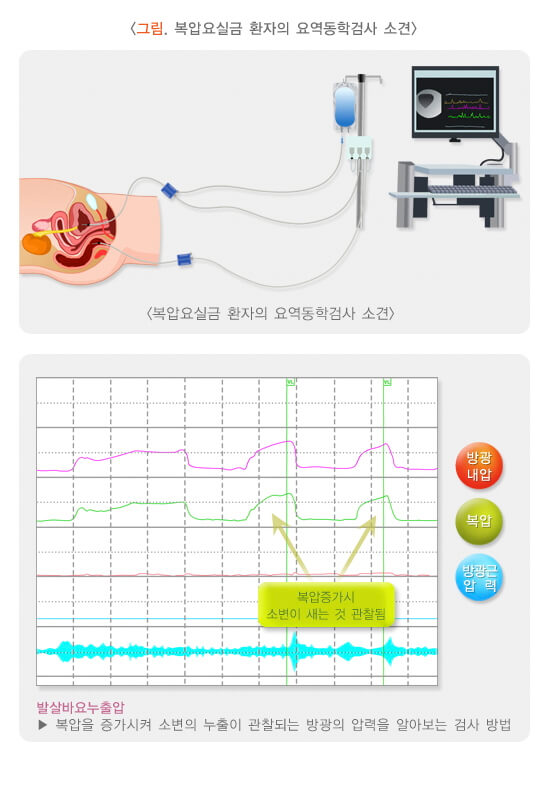 요실금 치료방법&amp;#44; 요실금 수술 비용&amp;#44; 요실금 팬티&amp;#44; 요실금 치료기 추천&amp;#44; 요실금 병원