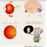 녹내장 증상 및 치료방법