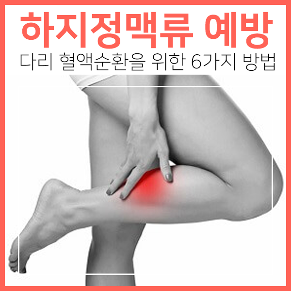 하지정맥류