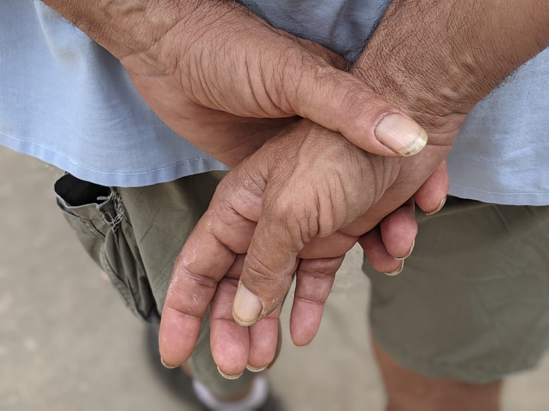 Arthritis