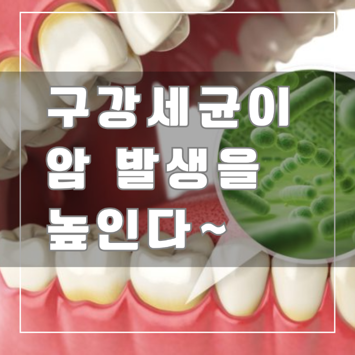 구강세균이 암 발생 위험을 높인다.
