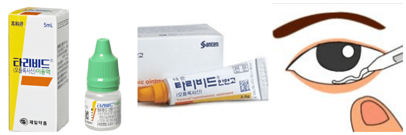 타리비드 안연고, 안연고 사용법 사진