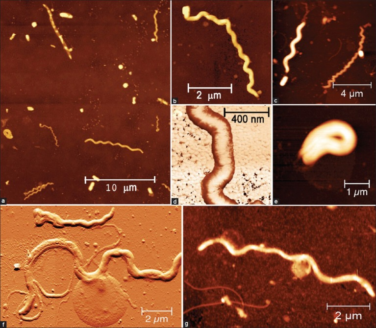 [A65-A69] 기타 스피로헤타질환(A65-A69)
