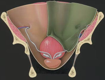 전립선 비대증 증상 치료 수술비용