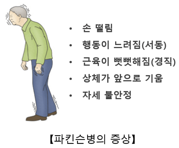 파킨슨병 증상
