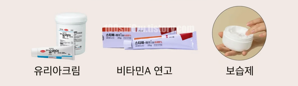모공각화증-관리법